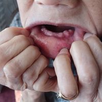 Affordable Dentures & Implants ico