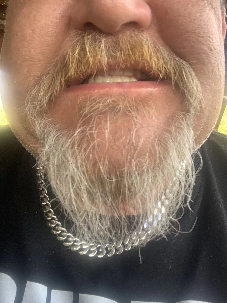 Affordable Dentures & Implants Picture 4