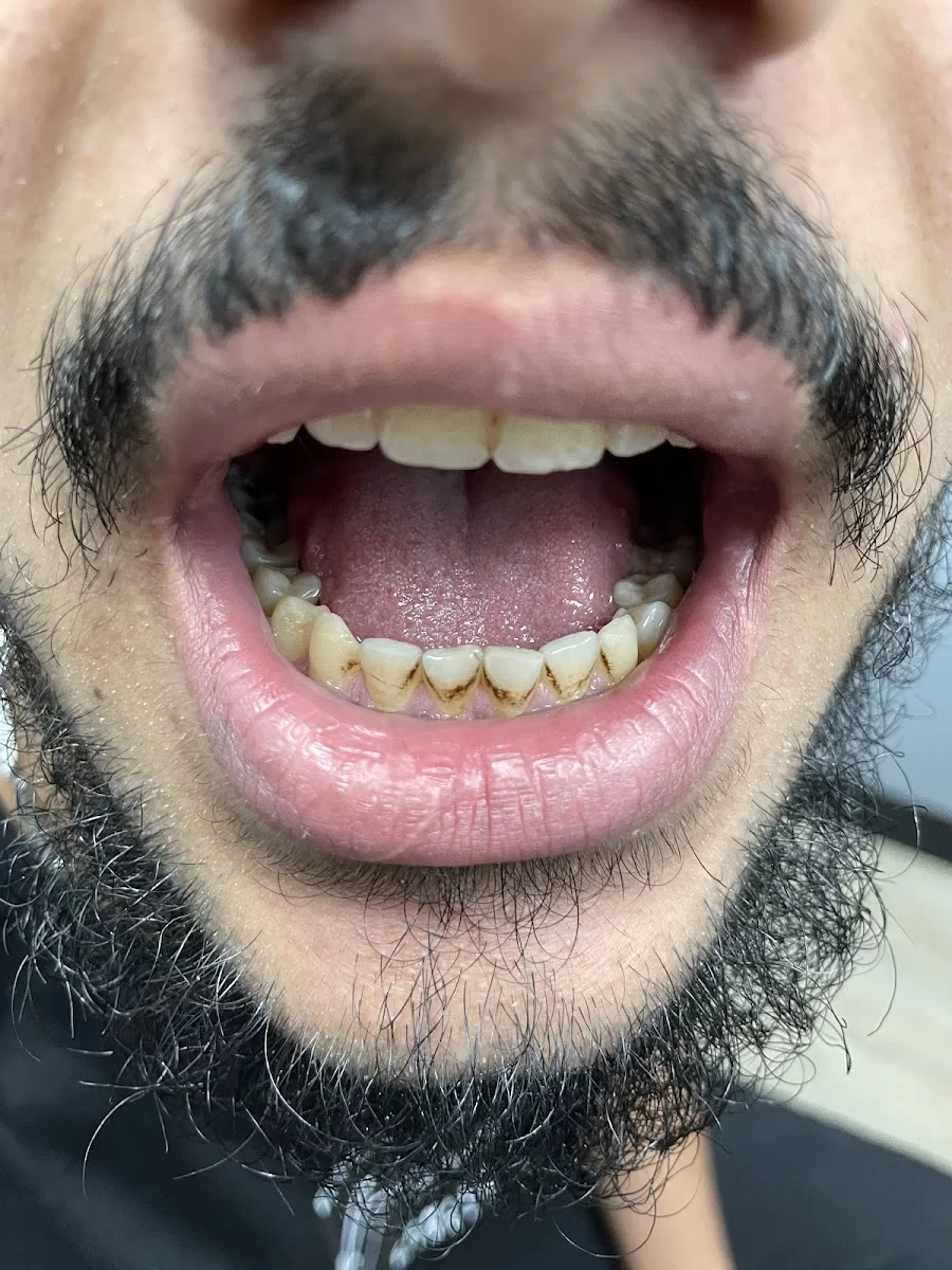 Affordable Dentures & Implants Picture 7