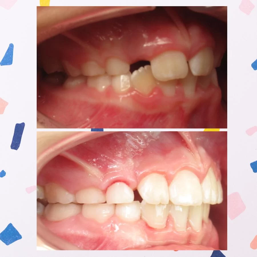Anderson and Ditcharo Orthodontics Picture 9