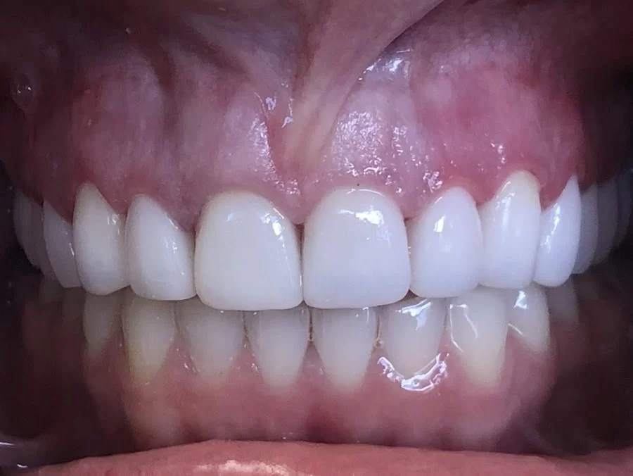 Whillock Dental Arts Picture 3