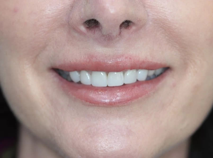 Whillock Dental Arts Picture 4