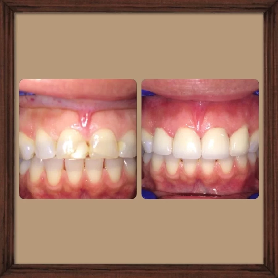 Fullerton Dental Care Picture 2