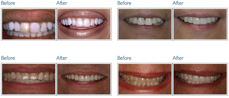 Gage Dental Care Picture 3