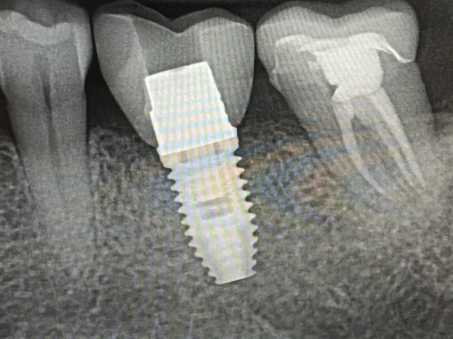 John U Choi DDS, PhD Picture 5