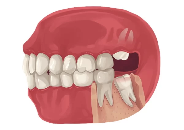 Summit Smiles / Dental Care: La Habra Picture 1