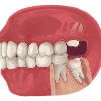 Summit Smiles / Dental Care: La Habra ico