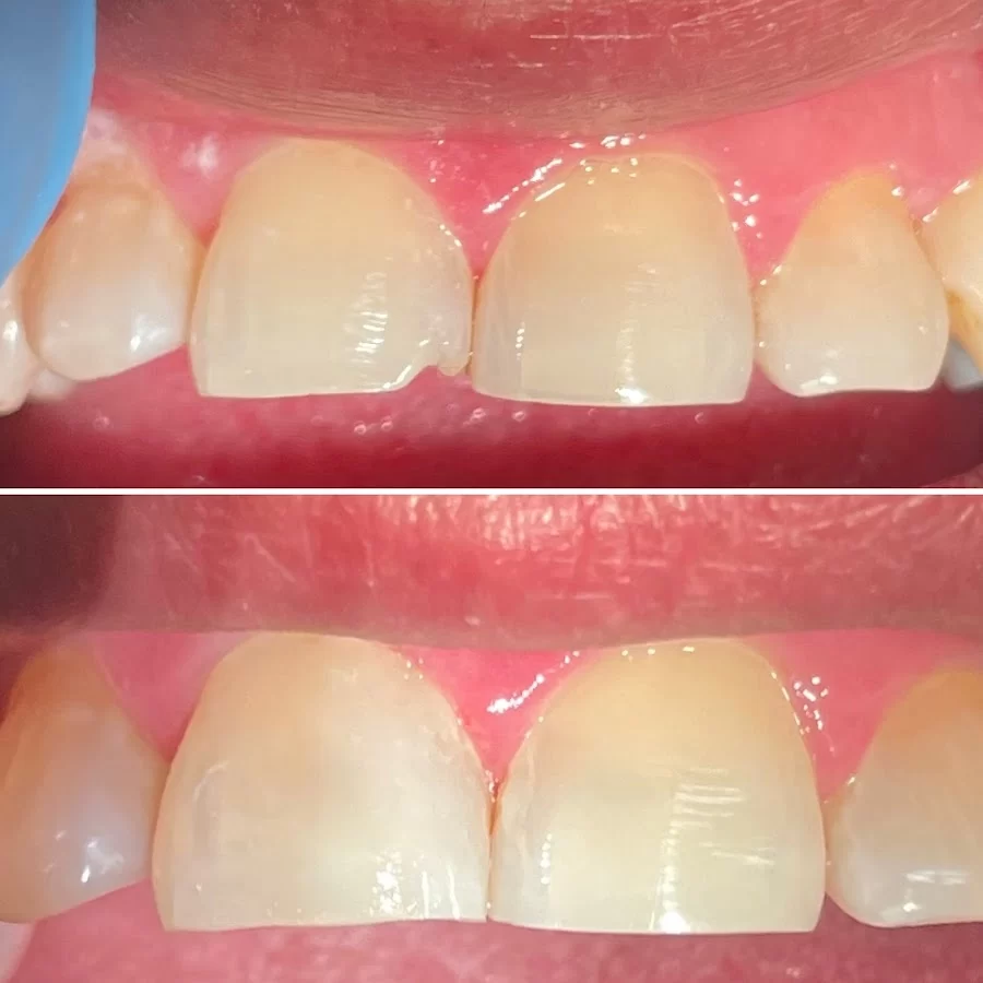 Sunland Smiles Dental Picture 4