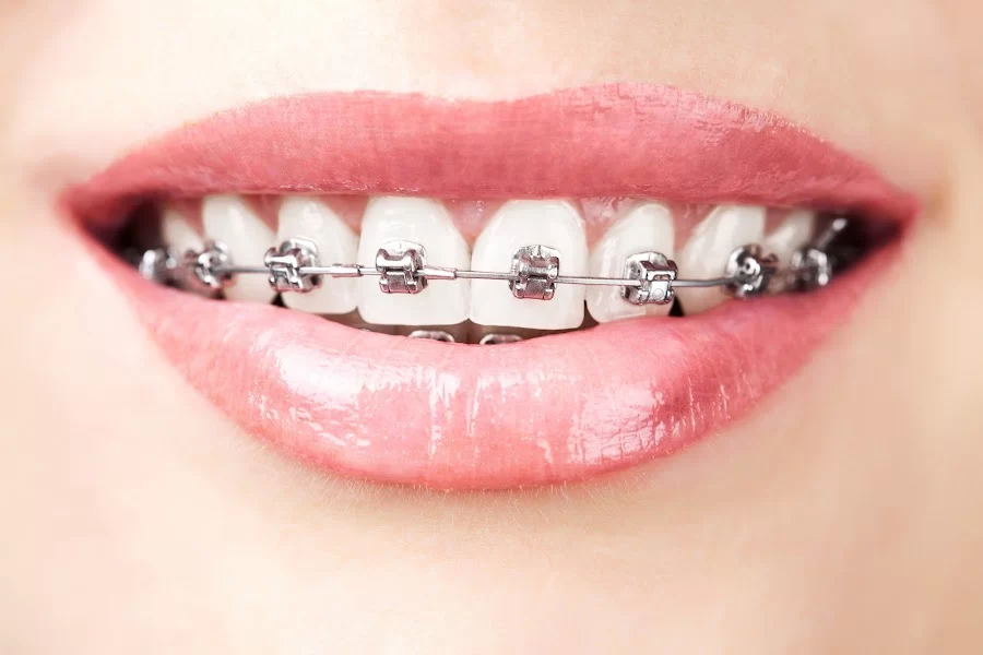Summer Smile Dental South Gate Picture 1