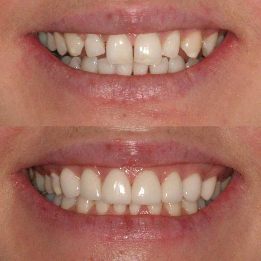 Summer Smile Dental South Gate Picture 10