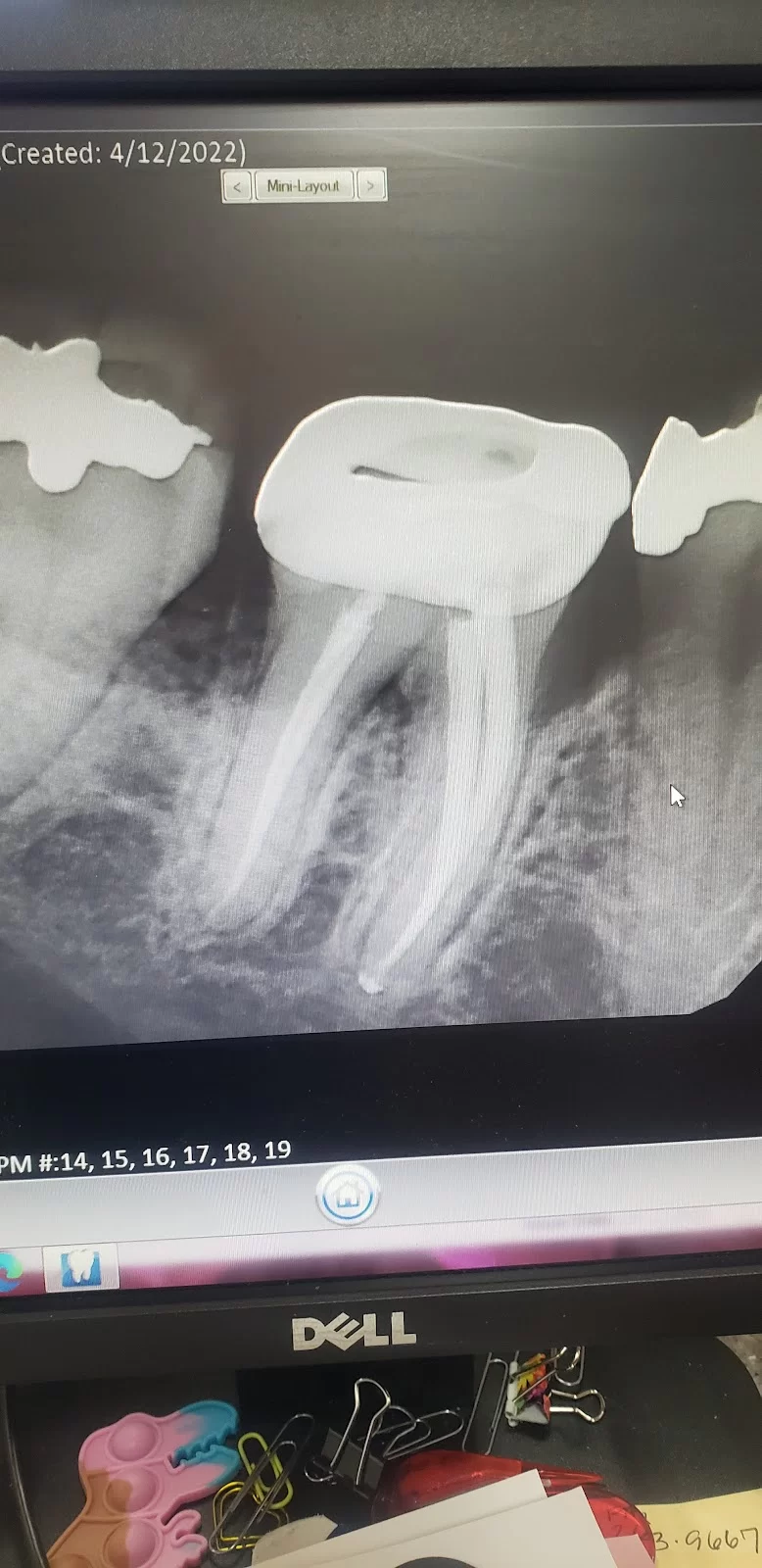 Dentist Culver City - Ocean Breeze Dental - Cosmetic and Emergency Dentist Picture 8
