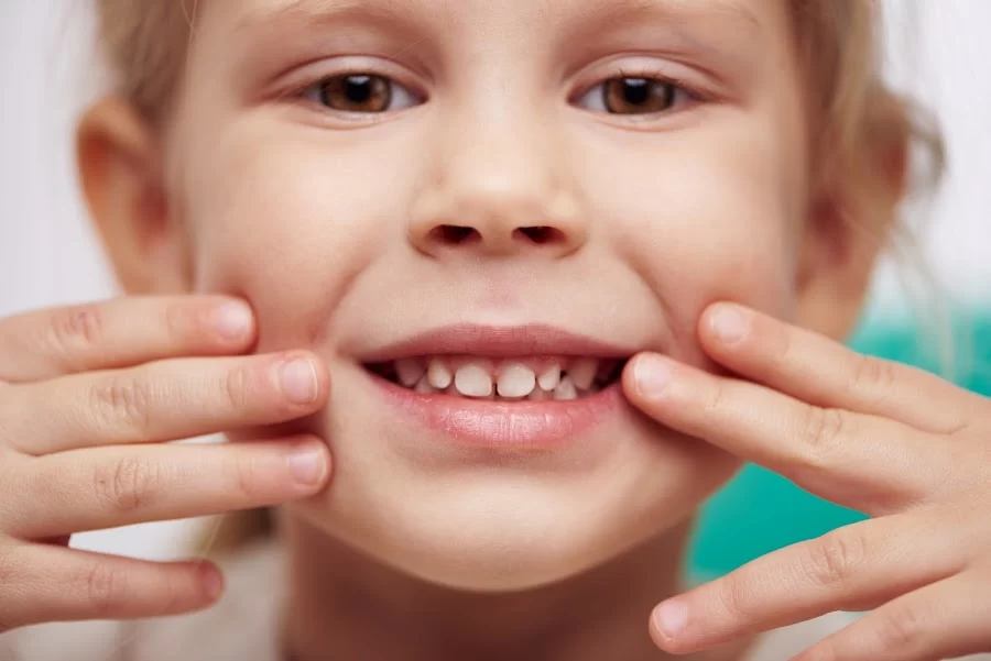 Dentist Culver City - Ocean Breeze Dental - Cosmetic and Emergency Dentist Picture 4