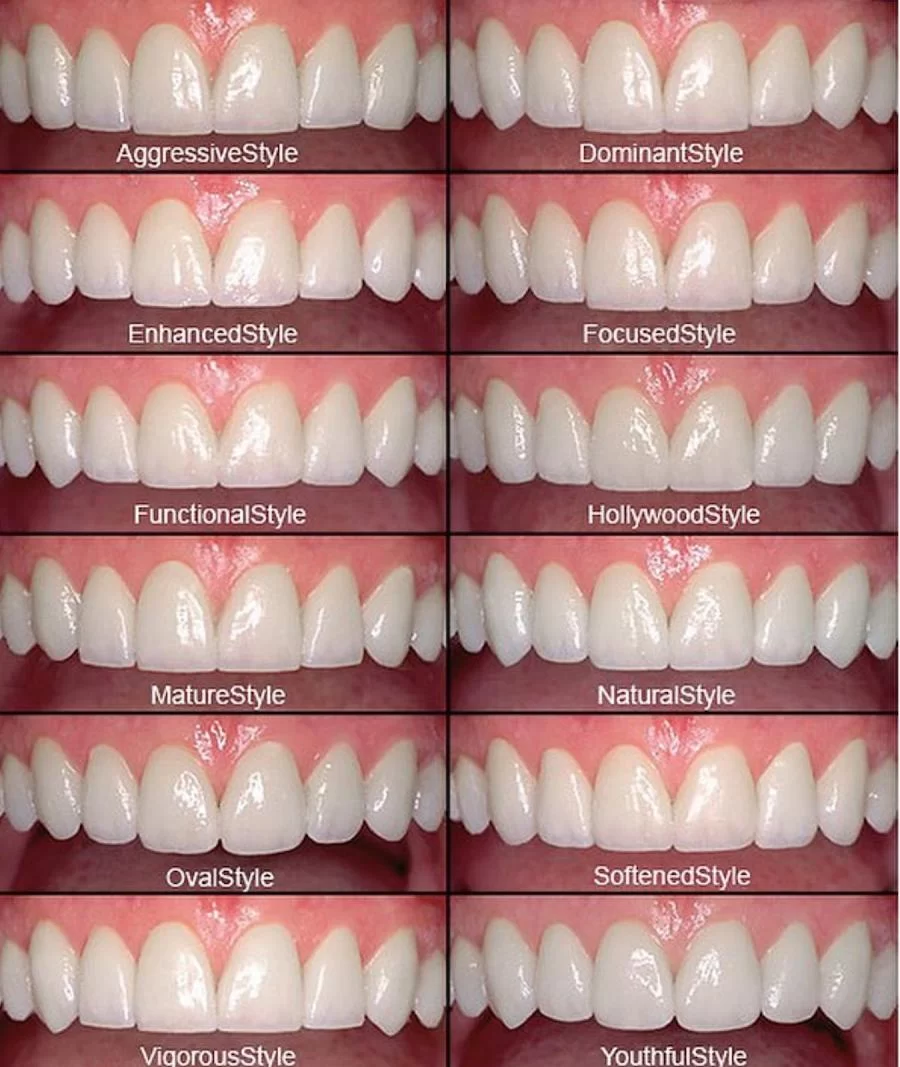 Dentist Culver City - Ocean Breeze Dental - Cosmetic and Emergency Dentist Picture 10