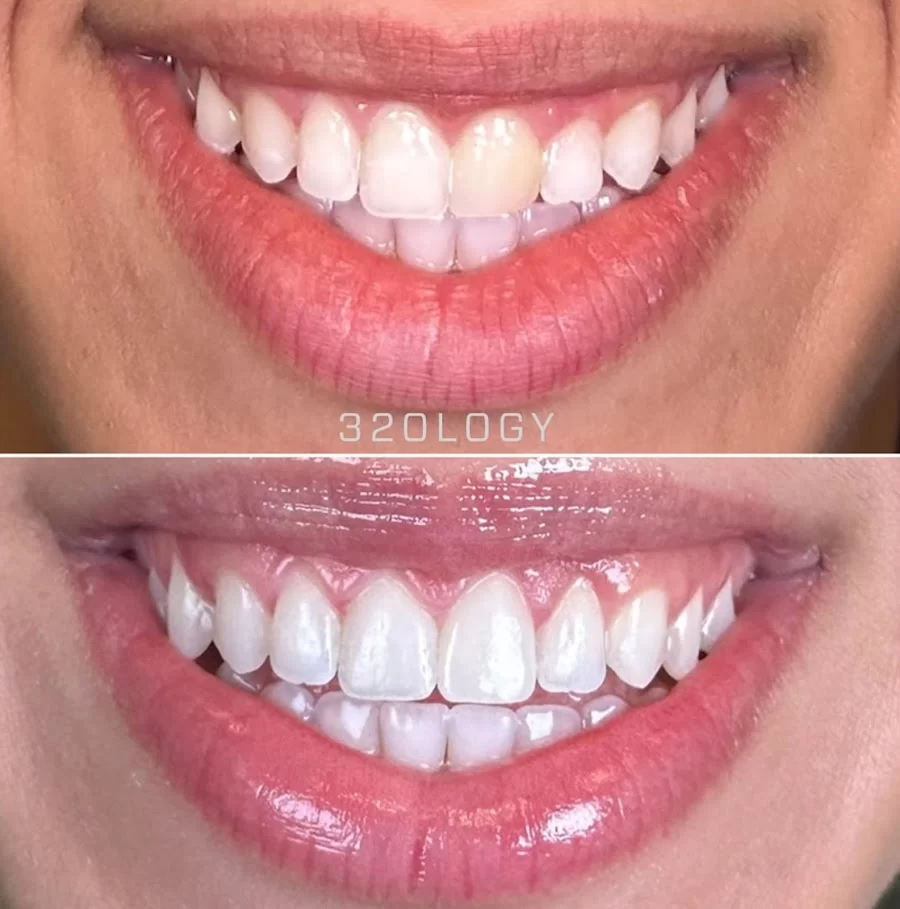 32ology Dental Studio - Argina Kudaverdian, DDS Picture 5