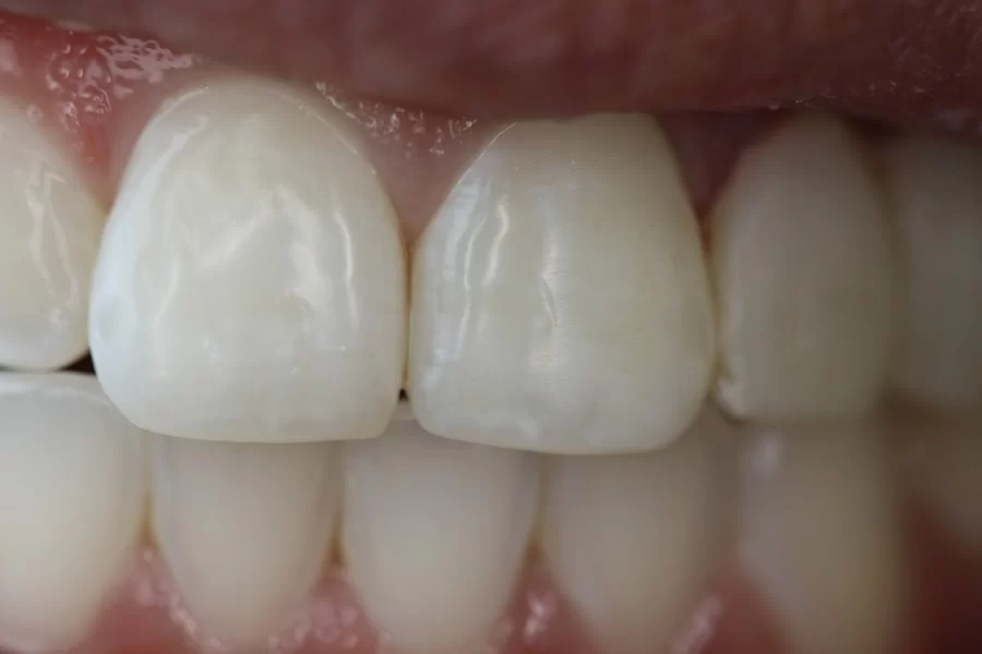 Tarzana Smiles - Garo Ourfalian, DDS Picture 1