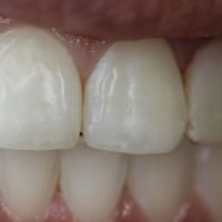 Tarzana Smiles - Garo Ourfalian, DDS ico
