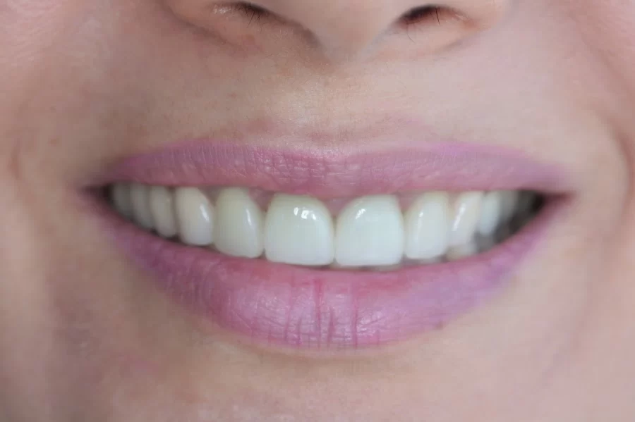 Tarzana Smiles - Garo Ourfalian, DDS Picture 3