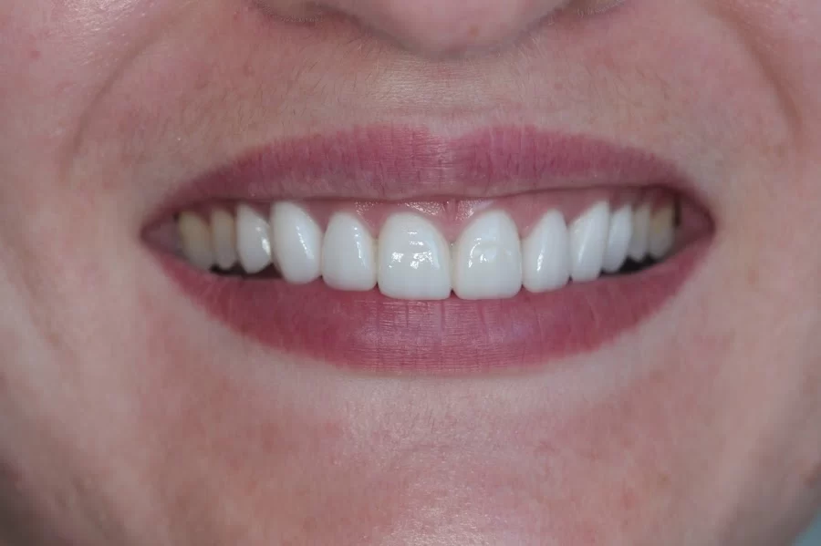Tarzana Smiles - Garo Ourfalian, DDS Picture 4