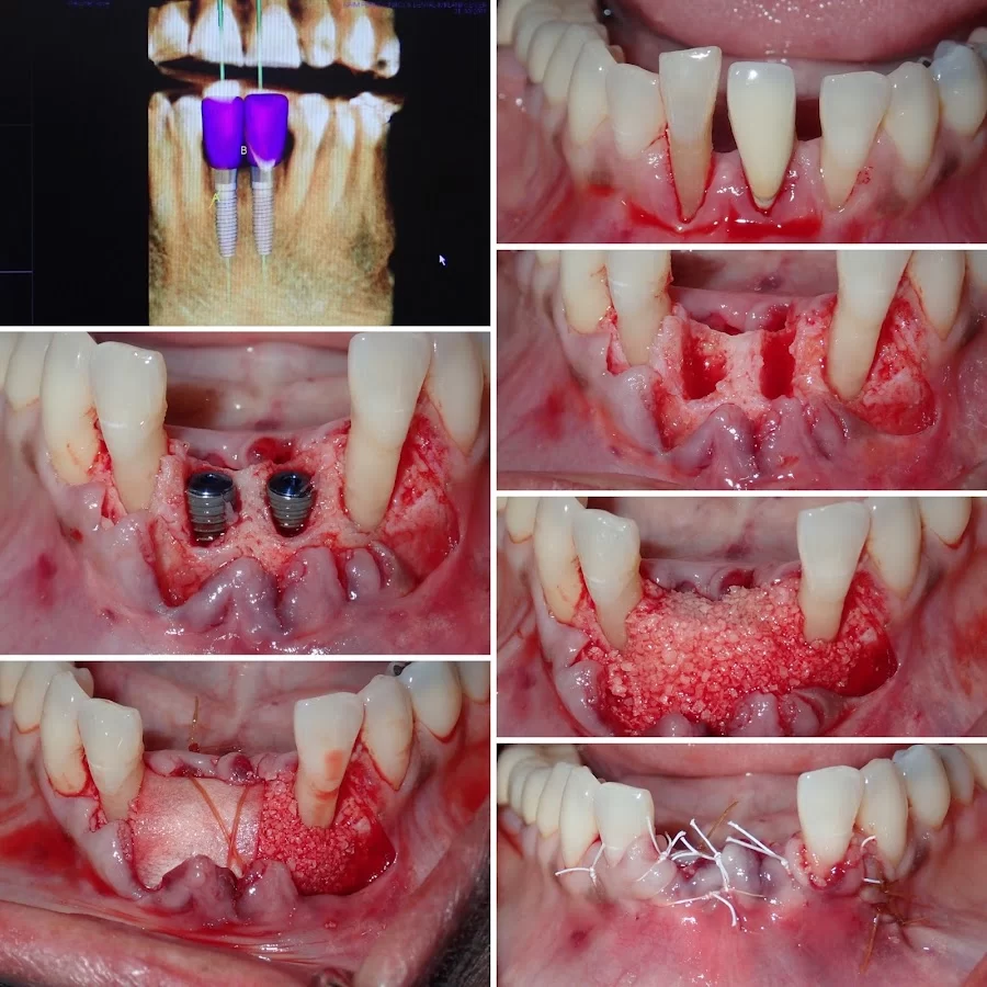 Sam I. Naim, DDS - Periodontics & Dental Implant Center in Encino Picture 8