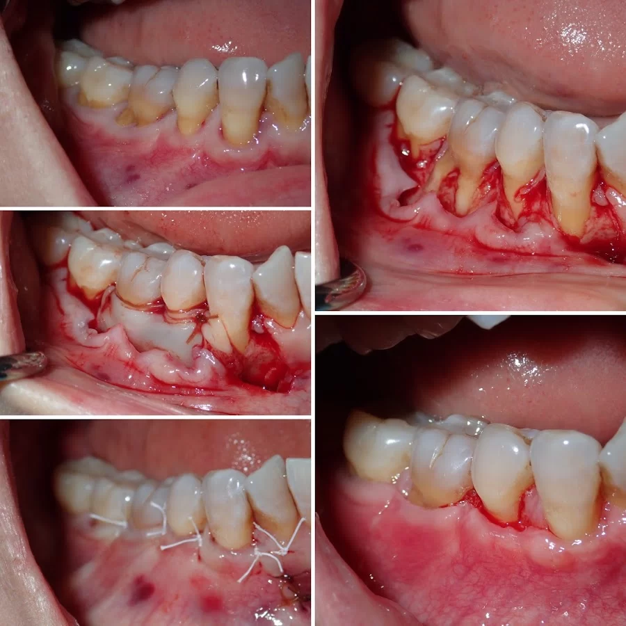 Sam I. Naim, DDS - Periodontics & Dental Implant Center in Encino Picture 3