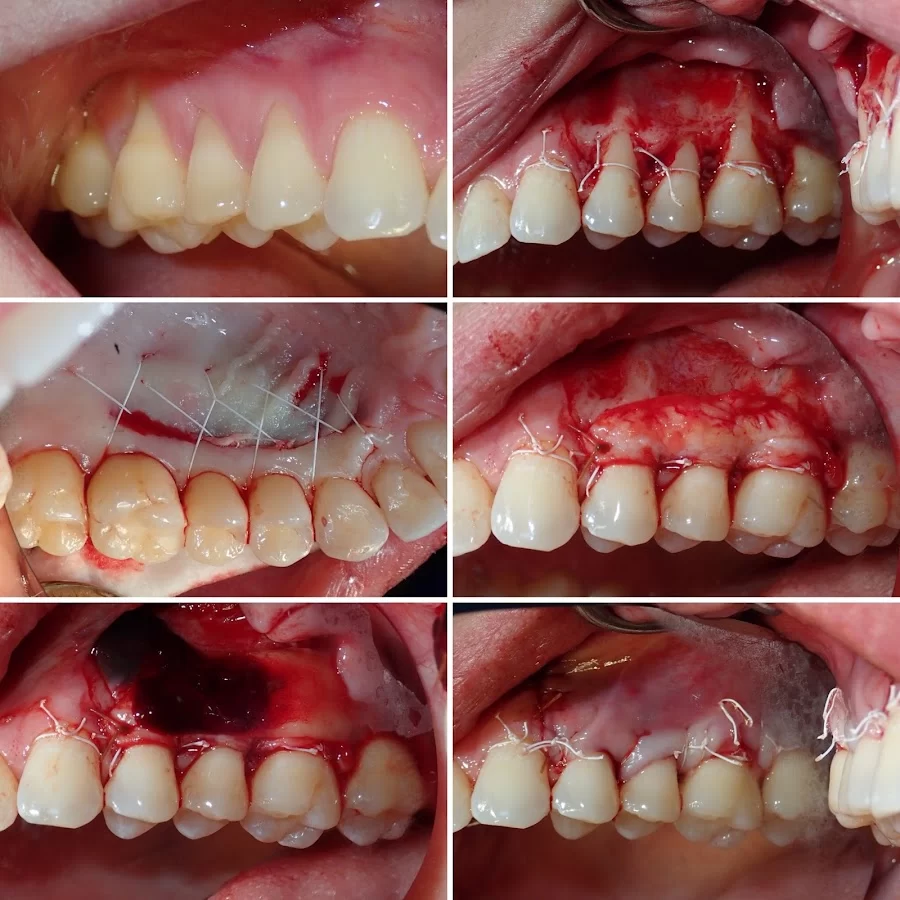 Sam I. Naim, DDS - Periodontics & Dental Implant Center in Encino Picture 5