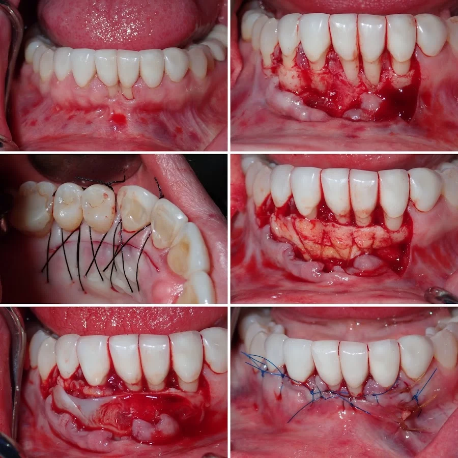 Sam I. Naim, DDS - Periodontics & Dental Implant Center in Encino Picture 7