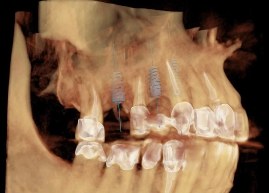 Sam I. Naim, DDS - Periodontics & Dental Implant Center in Encino Picture 2
