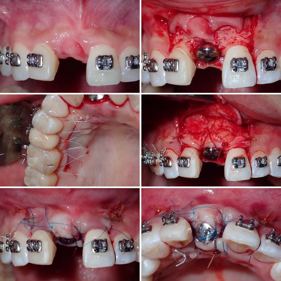 Sam I. Naim, DDS - Periodontics & Dental Implant Center in Encino Picture 10