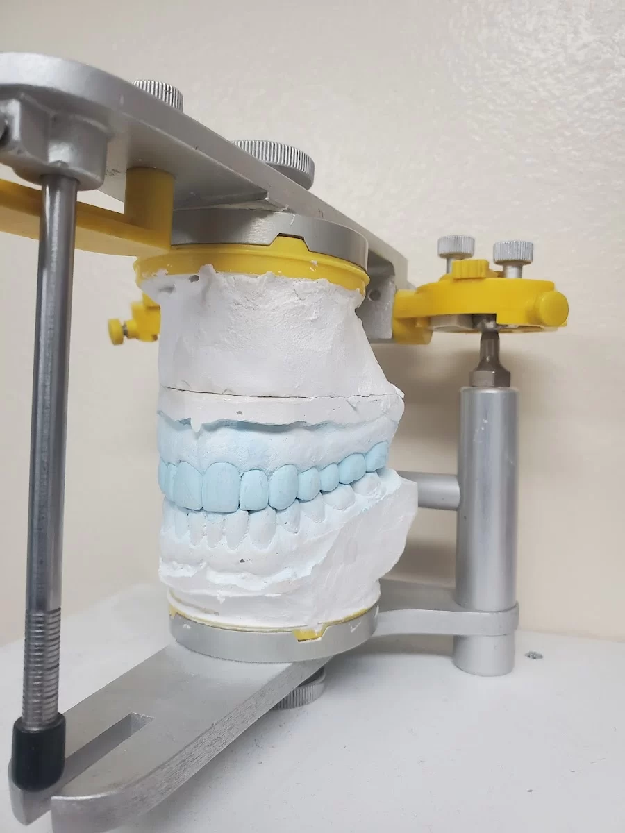 Dental Plus Tarzana Picture 4