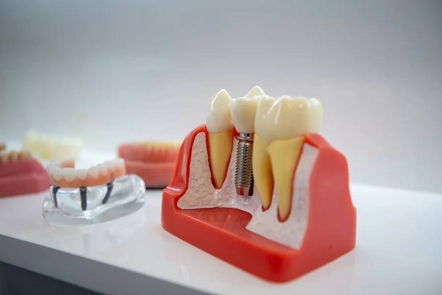 Synergy Dental Implant & Oral Surgery Center Picture 1