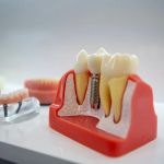 Synergy Dental Implant & Oral Surgery Center