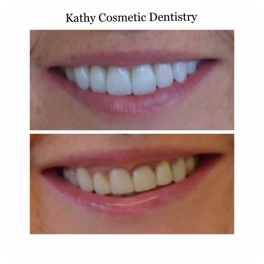 Kathy Cosmetic Dentistry Picture 3