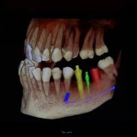 The Tender Dentist ico