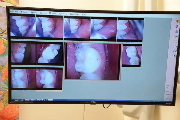 The Tender Dentist Picture 8