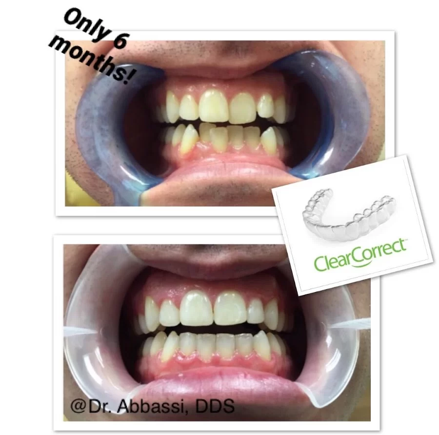 Dr. Summy Abbassi, DDS Picture 5