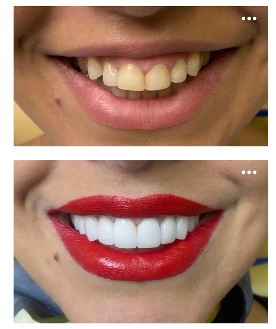Dr. Summy Abbassi, DDS Picture 9