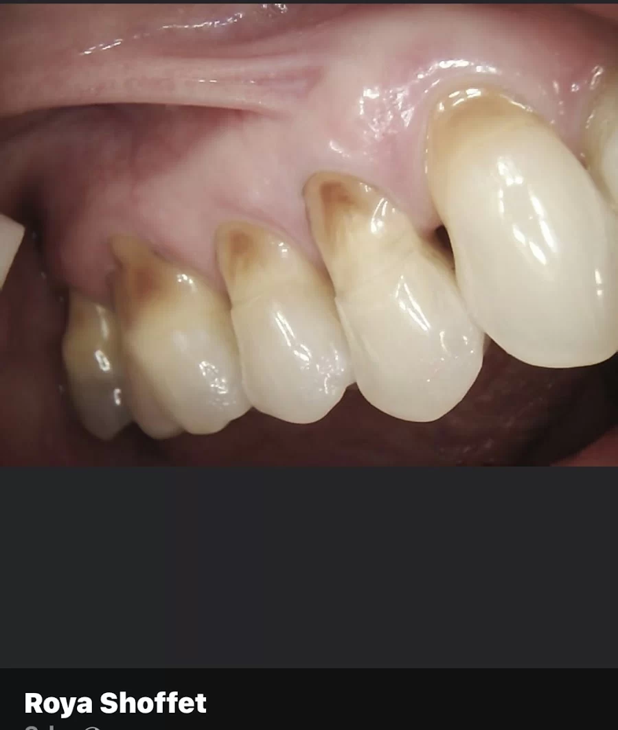 Royal Dental Practice | Dr. Roya Shoffet-Yaghoubian Picture 2