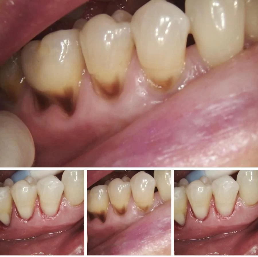 Royal Dental Practice | Dr. Roya Shoffet-Yaghoubian Picture 8