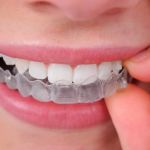 Canoga Park Dental