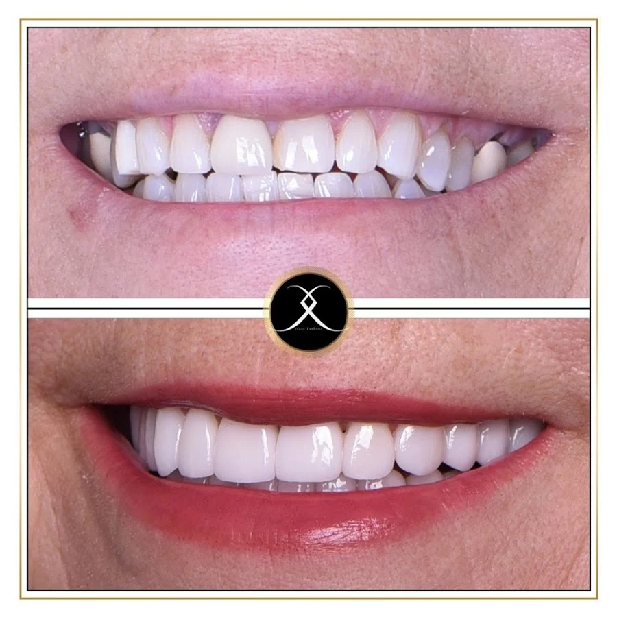 Northridge Advanced Dentistry | Northridge Dentist Picture 4