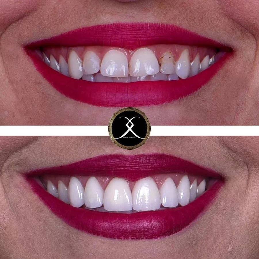 Northridge Advanced Dentistry | Northridge Dentist Picture 7