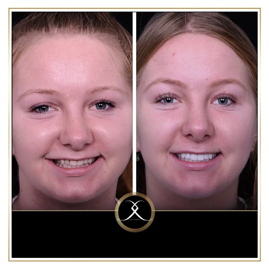 Northridge Advanced Dentistry | Northridge Dentist Picture 3