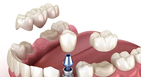Arcadia Dental Group Picture 1