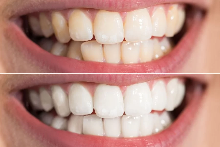 Dr. David Hakham, Dentist in Montebello Picture 1