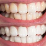 Dr. David Hakham, Dentist in Montebello