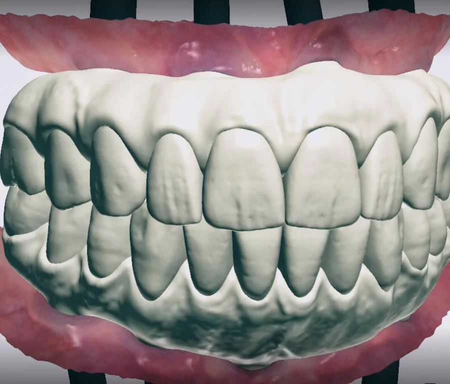 Burbank Dental Implants: Ramsey A. Amin D.D.S. Picture 7