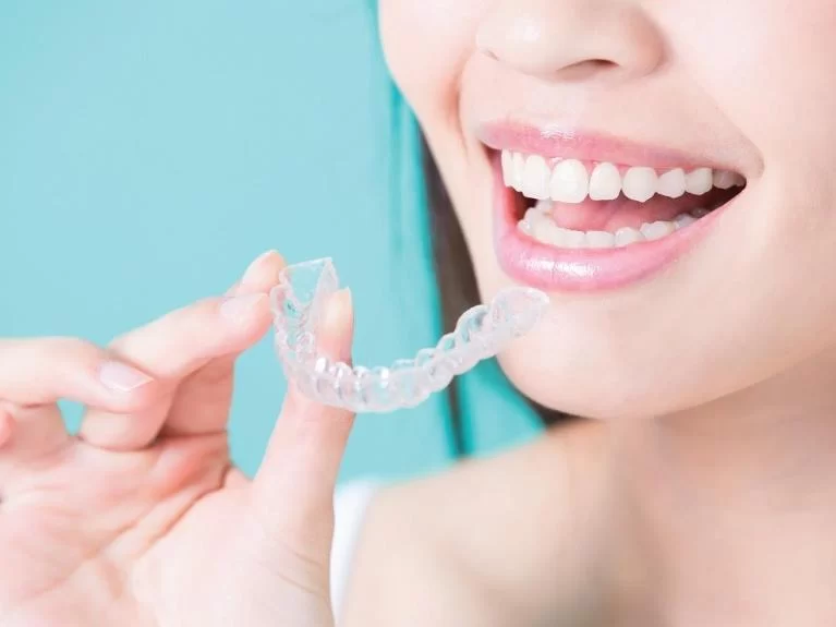 How to Fix Misaligned Teeth Without Surgery: Non-Surgical Solutions for a Perfect Smile