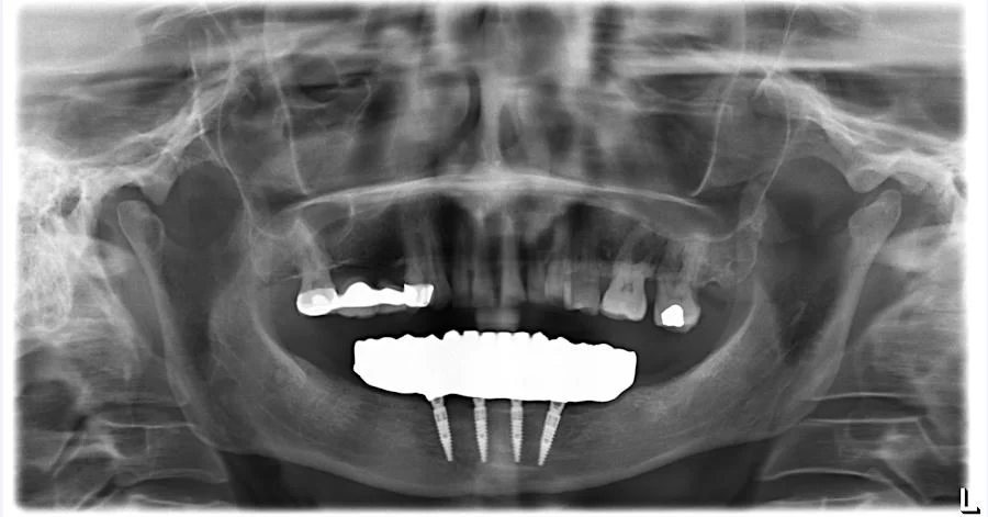 Kotikian Armond, MD, DDS, FACS Picture 3