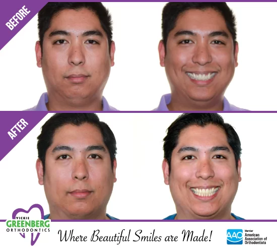 Greenberg Orthodontics, TMJ & Airway Picture 2