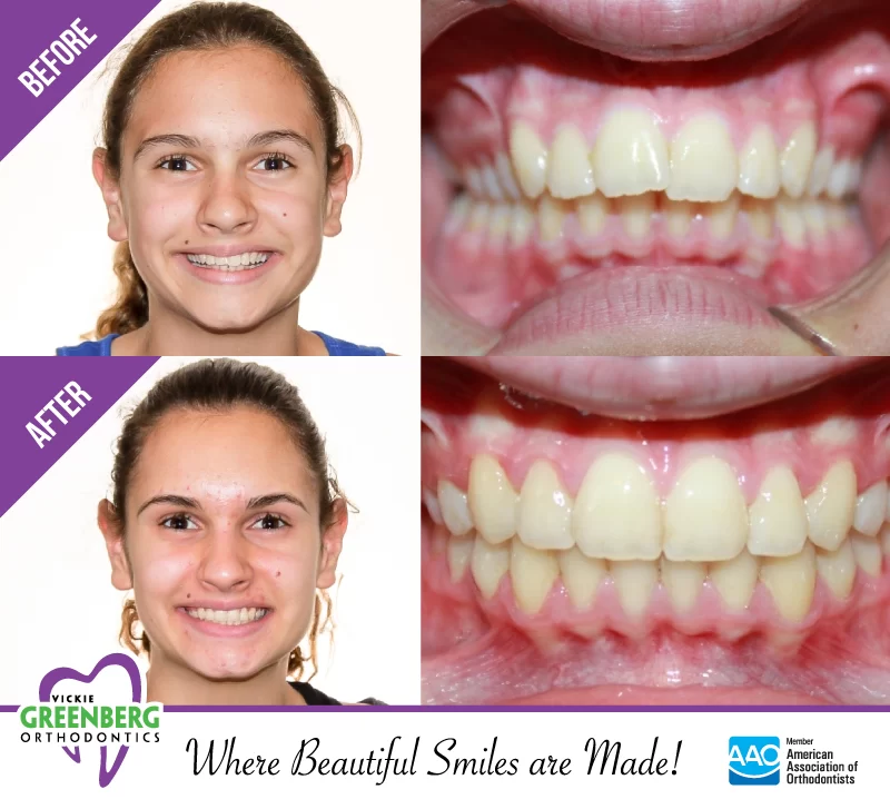 Greenberg Orthodontics, TMJ & Airway Picture 7